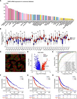 TGIF2 is a potential biomarker for diagnosis and prognosis of glioma